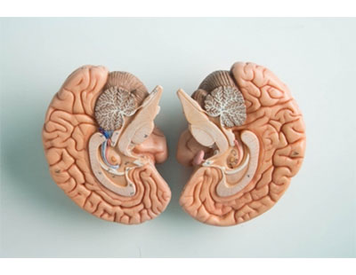 Probing a Parkinson’s Paradox