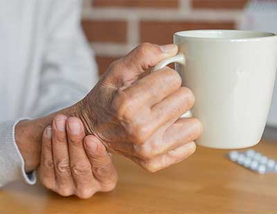 Cracking the Code of Parkinson’s: How Supercomputers Are Pointing to New Treatments