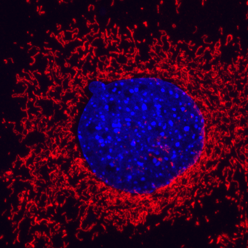 MRC PPU researchers receive major funding to explore new frontiers in Parkinson’s disease