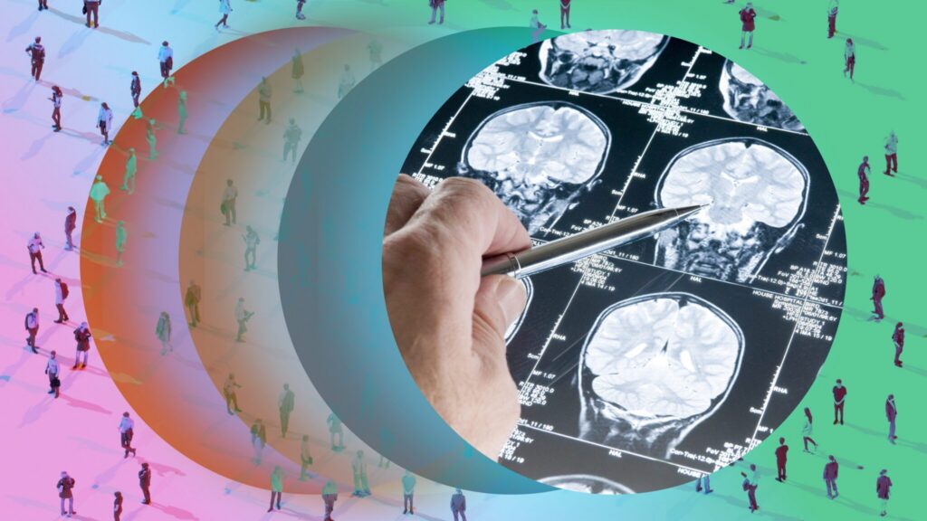 Genetic Representation in Parkinson’s Research Drives Progress